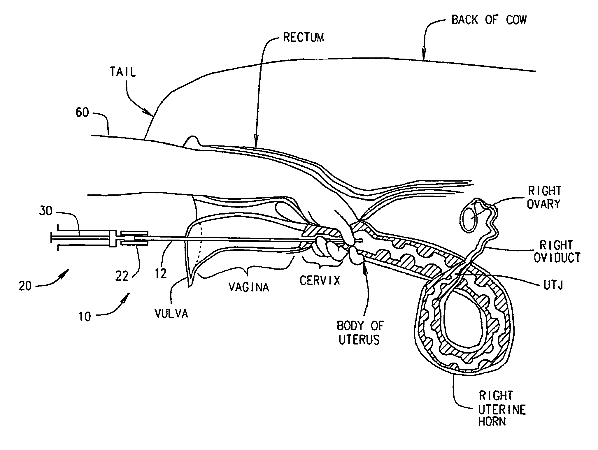 Artificial breeding techniques for bovines including semen diluents and AI apparatus