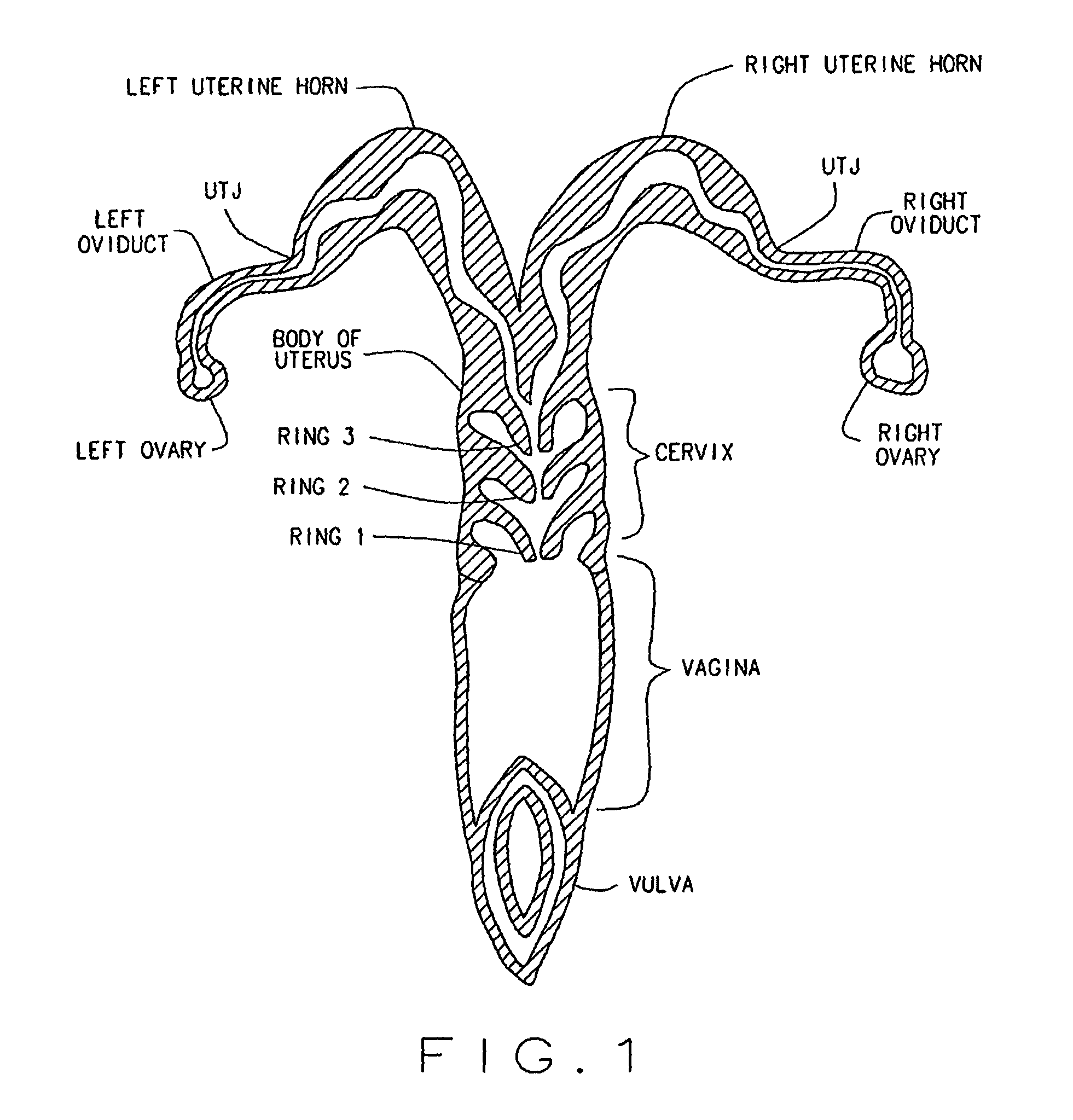 Artificial breeding techniques for bovines including semen diluents and AI apparatus