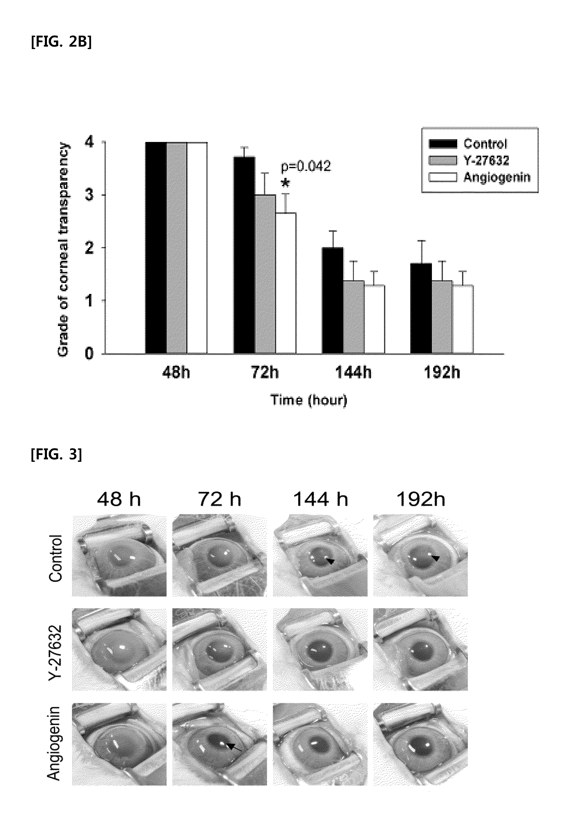 Pharmaceutical composition for treatment of corneal endothelial wounds containing angiogenin