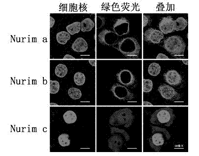 Marker for cancer detection and application thereof