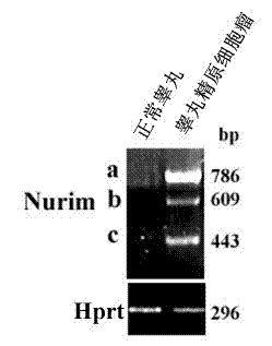 Marker for cancer detection and application thereof