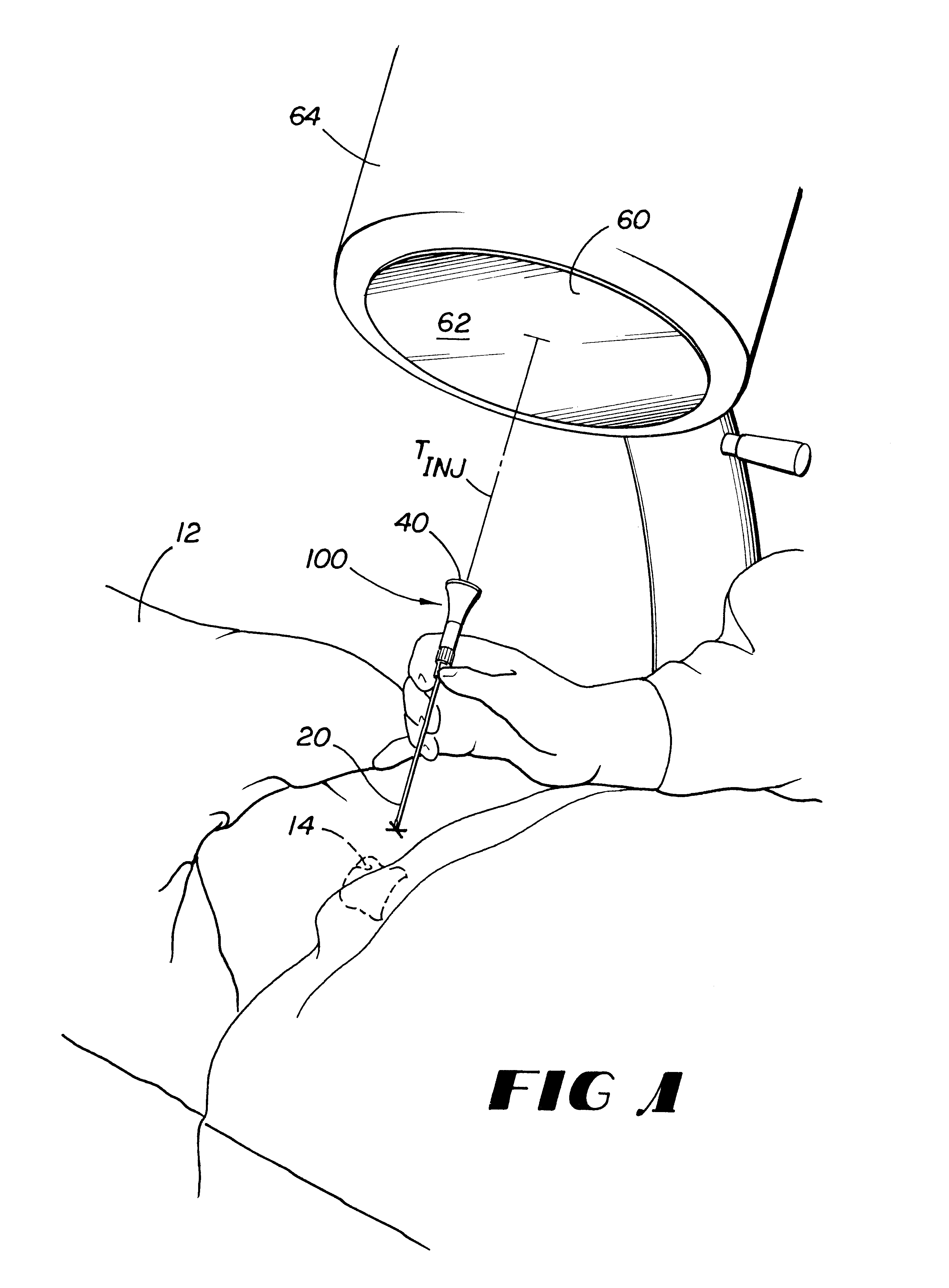 Percutaneous needle alignment system and associated method