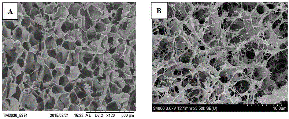 Silk fibroin hydrogel adopting IPN (interpenetrating polymer network) structure and preparation method of silk fibroin hydrogel