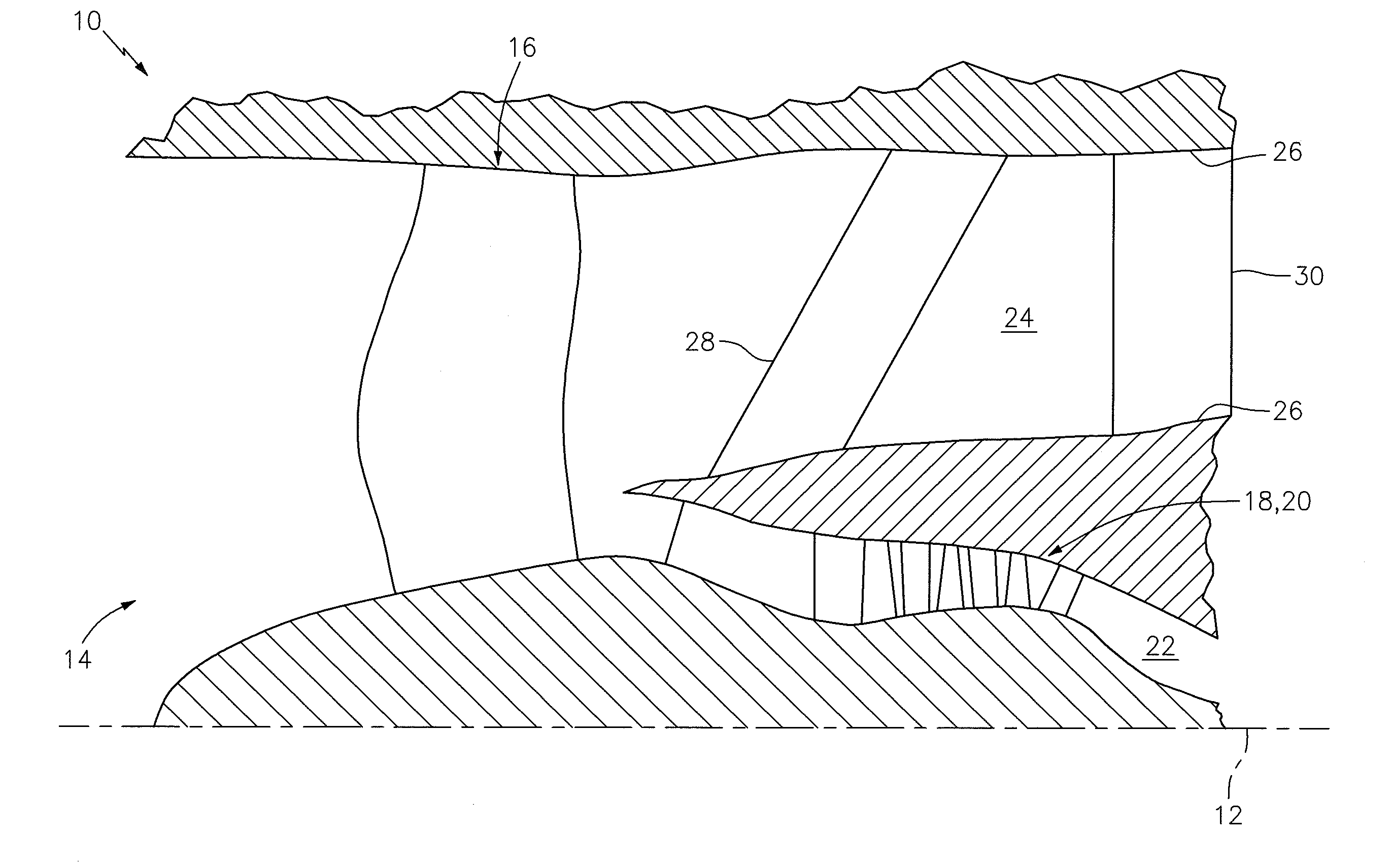 Flexible connection between a wall and a case of a turbine engine