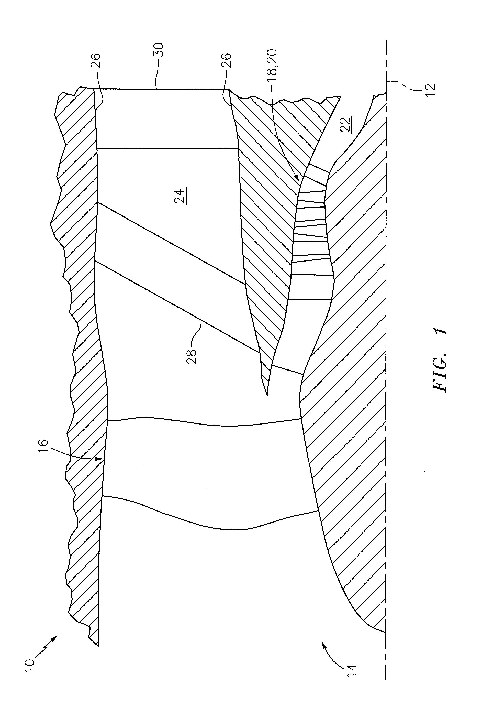 Flexible connection between a wall and a case of a turbine engine