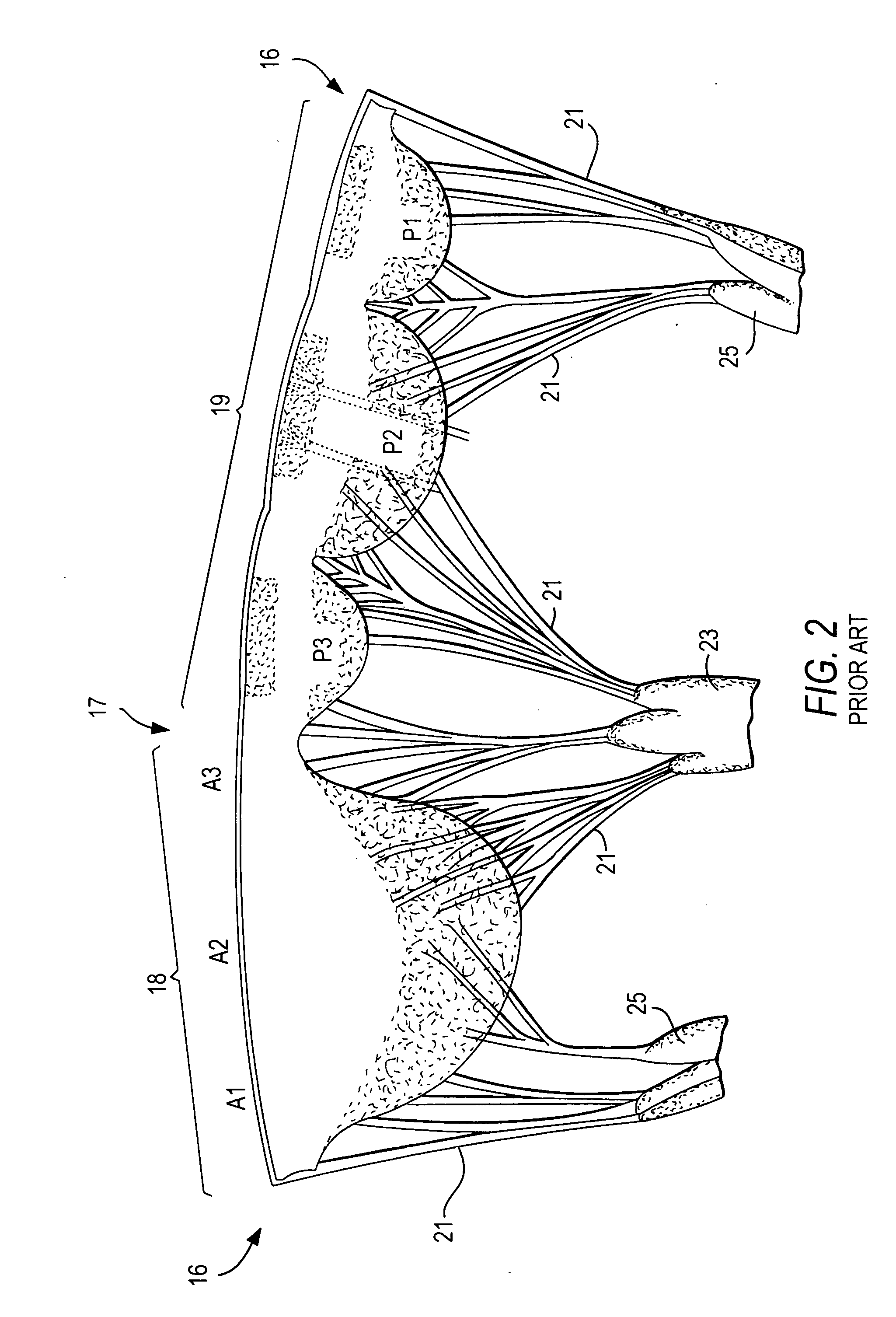 Saddle-shaped mitral valve annuloplasty prostheses with asymmetry, and related methods