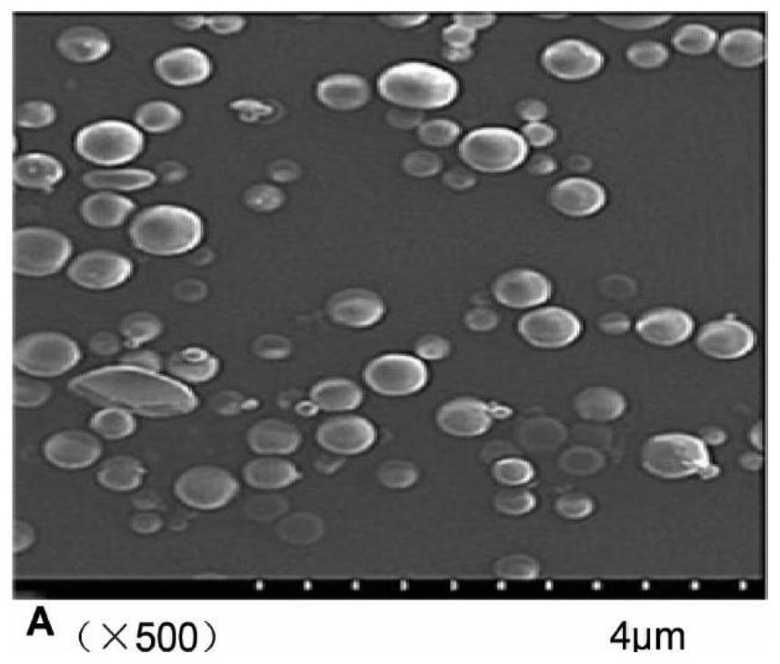 Anti-NGF antibody slow-release microspheres for reducing airway hyperreactivity and preparation method thereof