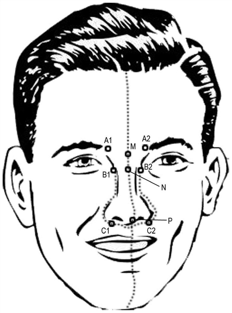 Face Image Rhinoplasty Method and Device