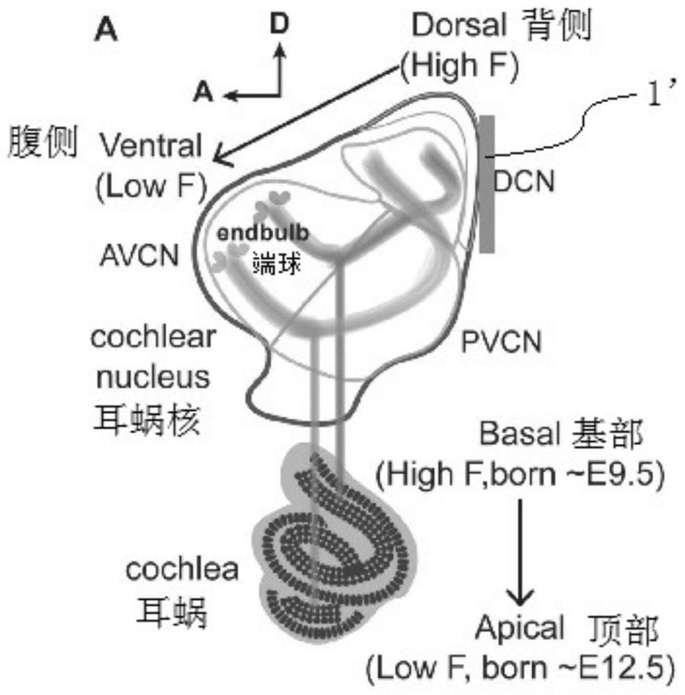 Quasi-neural electrode for accurate stimulation of cochlea nucleus