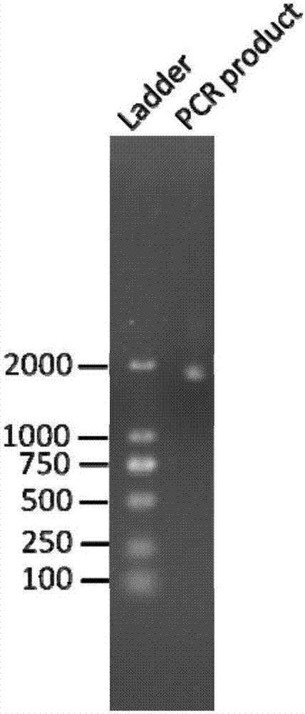 Allophanic acid hydrolase and preparation method thereof