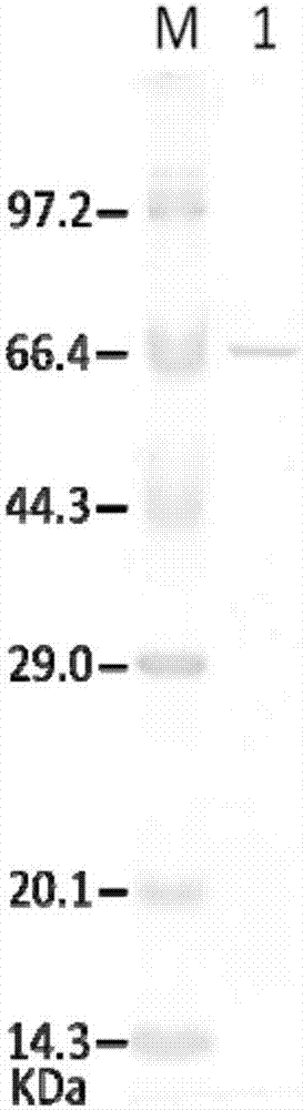 Allophanic acid hydrolase and preparation method thereof