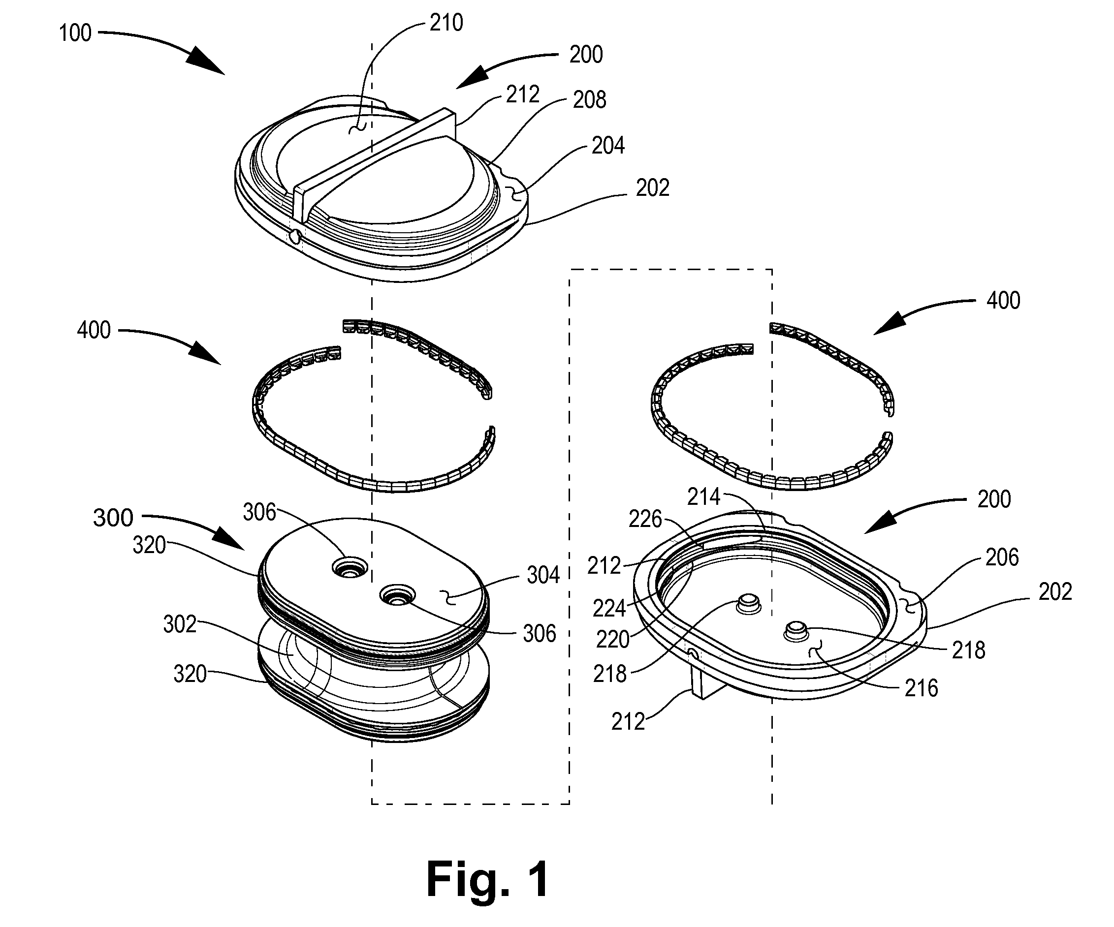 Orthopedic device assembly with elements coupled by a retaining structure