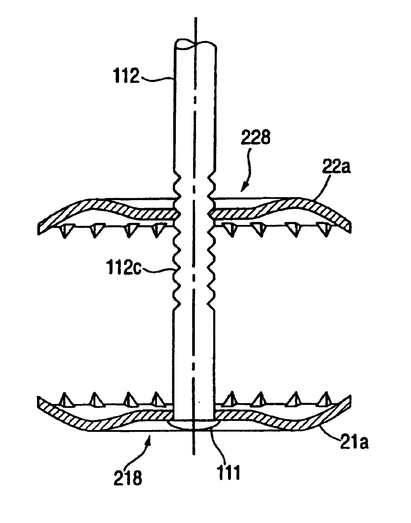 Device for postoperative fixation back into the cranium of a plug of bone removed therefrom during a surgical operation