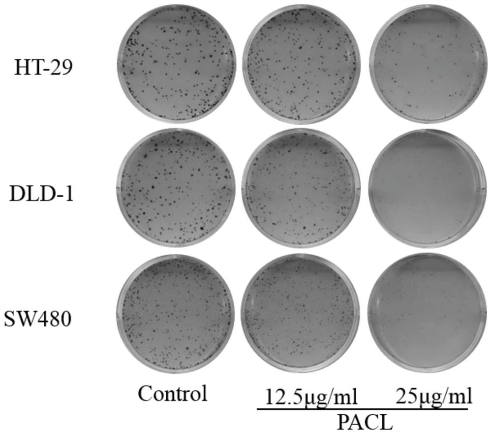 Tung flower leaf petroleum ether extract and its preparation and application in the treatment of colon cancer