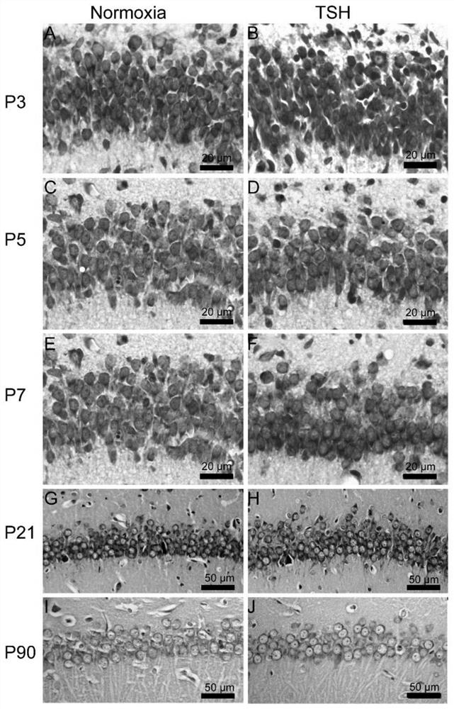 Preparation and application of animal model with broad brain region neuron tree sudden fertility disorder
