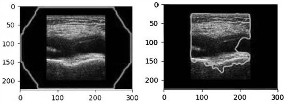 Ultrasound diagnosis method of knee joint disorders based on deep learning multi-channel and image embedding method