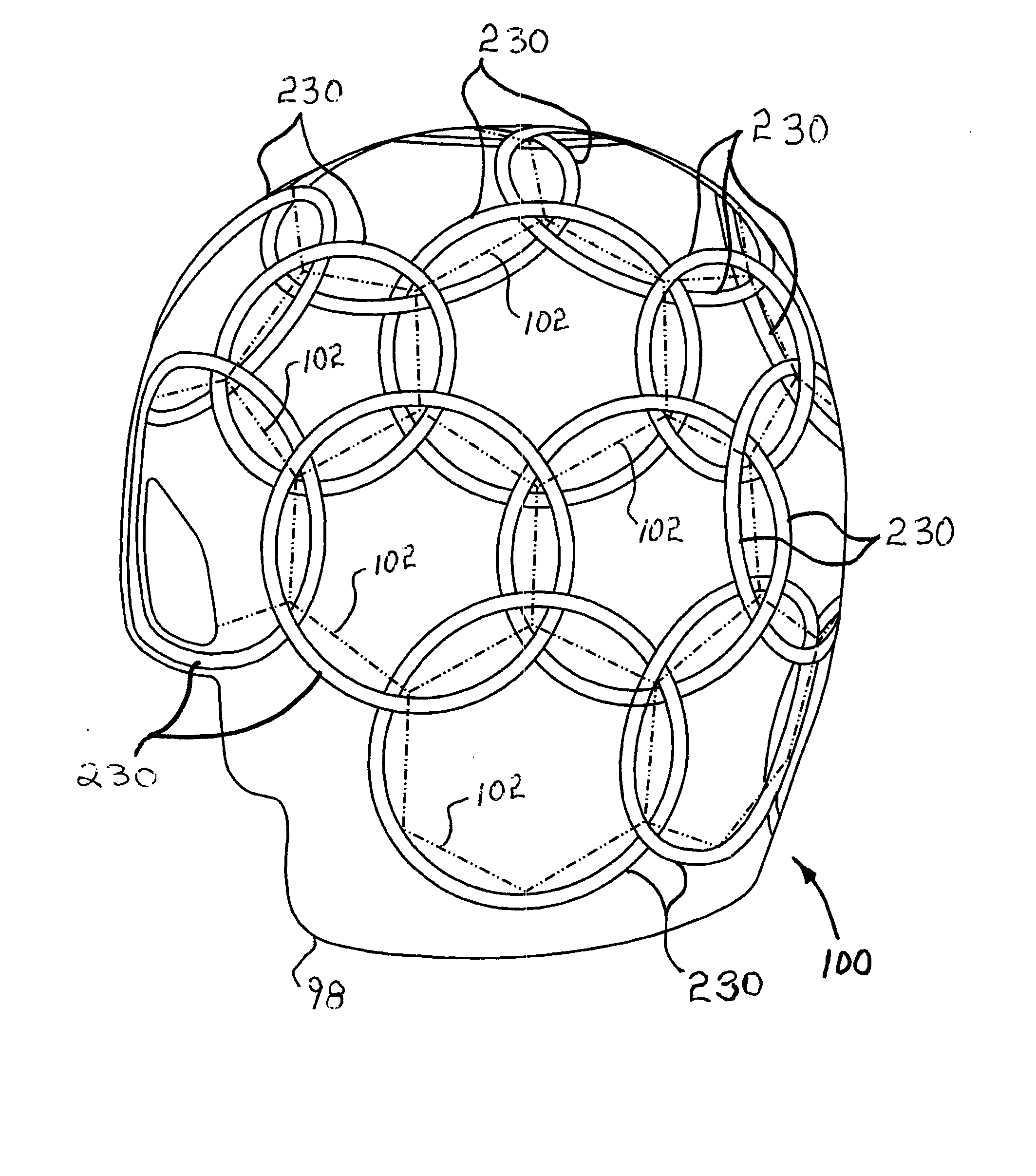 Shaped MRI Coil Array