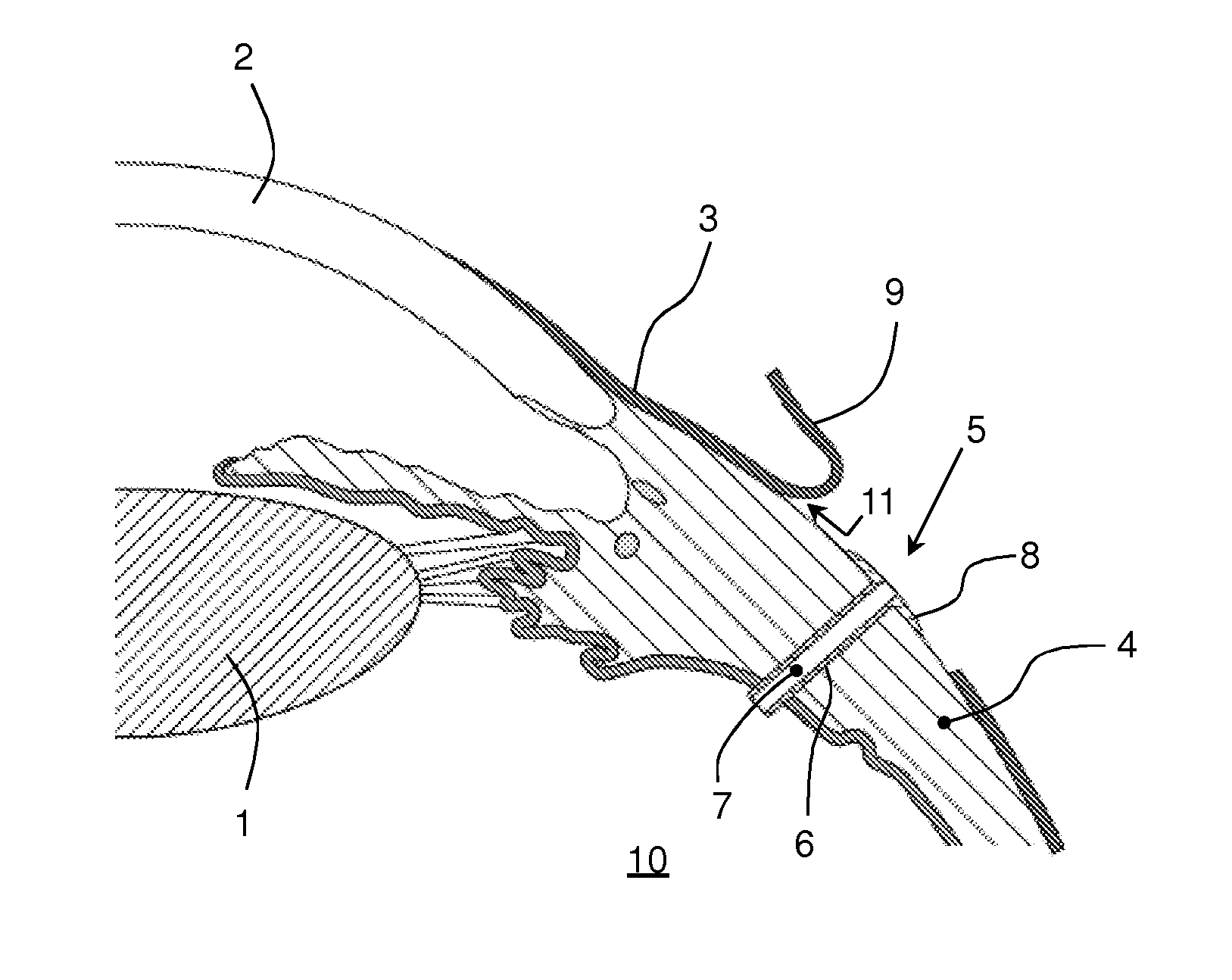 Device for use in glaucoma surgery