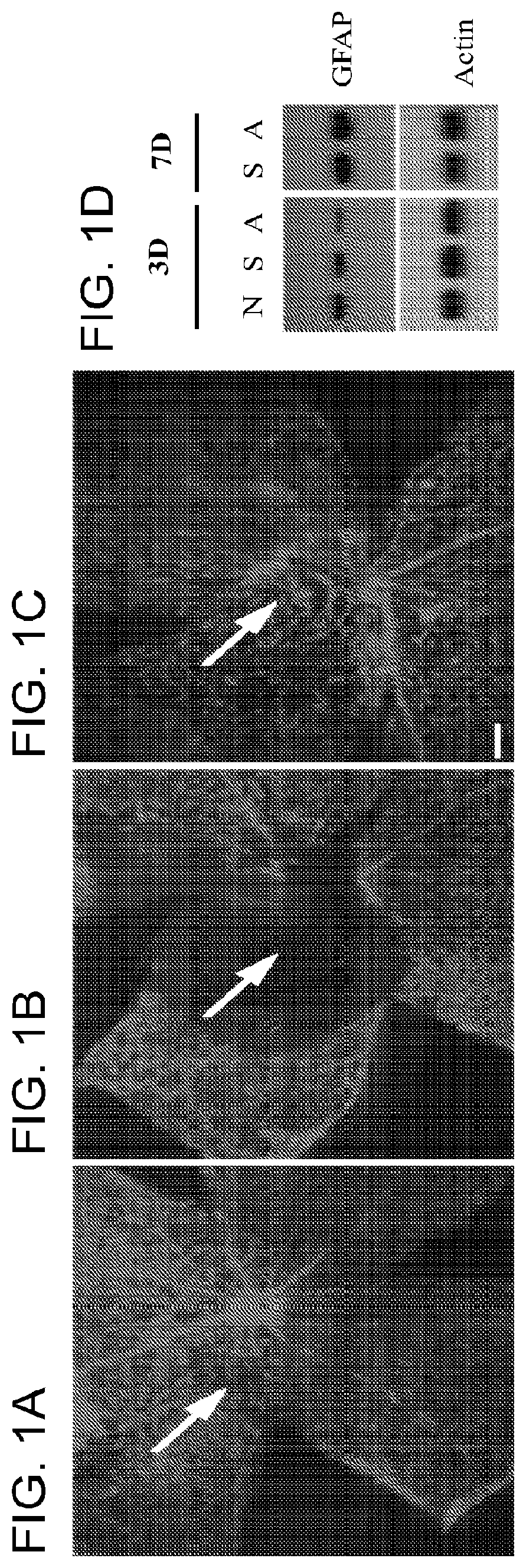 Alpha-aminoadipate for treatment of vision loss and restoring sight