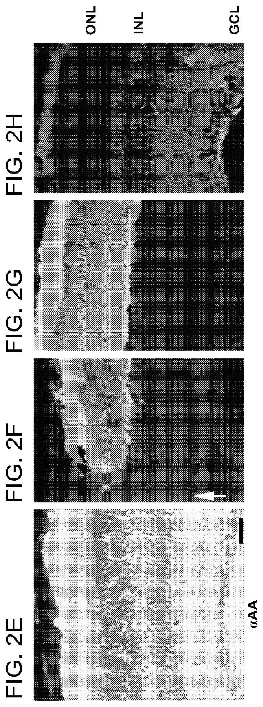 Alpha-aminoadipate for treatment of vision loss and restoring sight