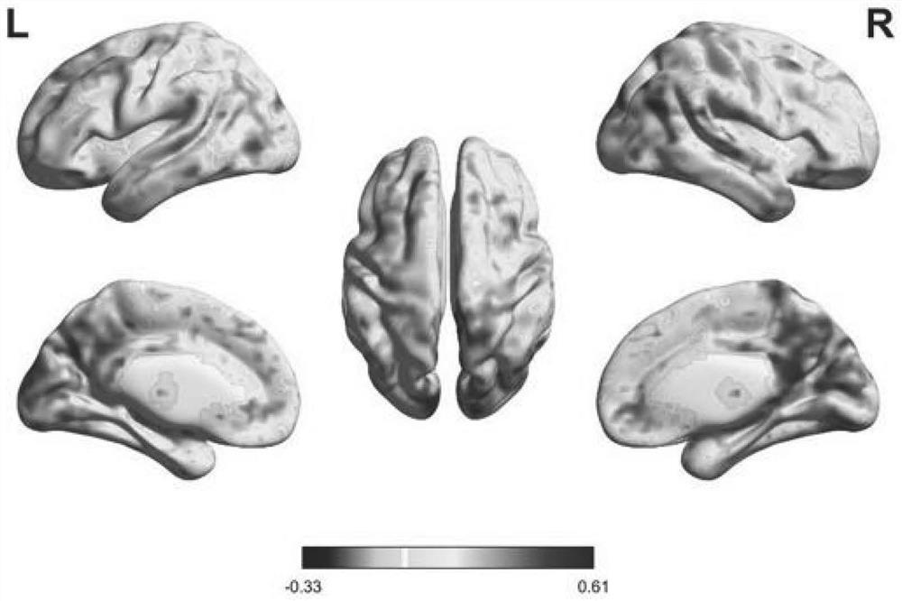 Individual space transcranial magnetic stimulation accurate positioning navigation method based on magnetic resonance imaging