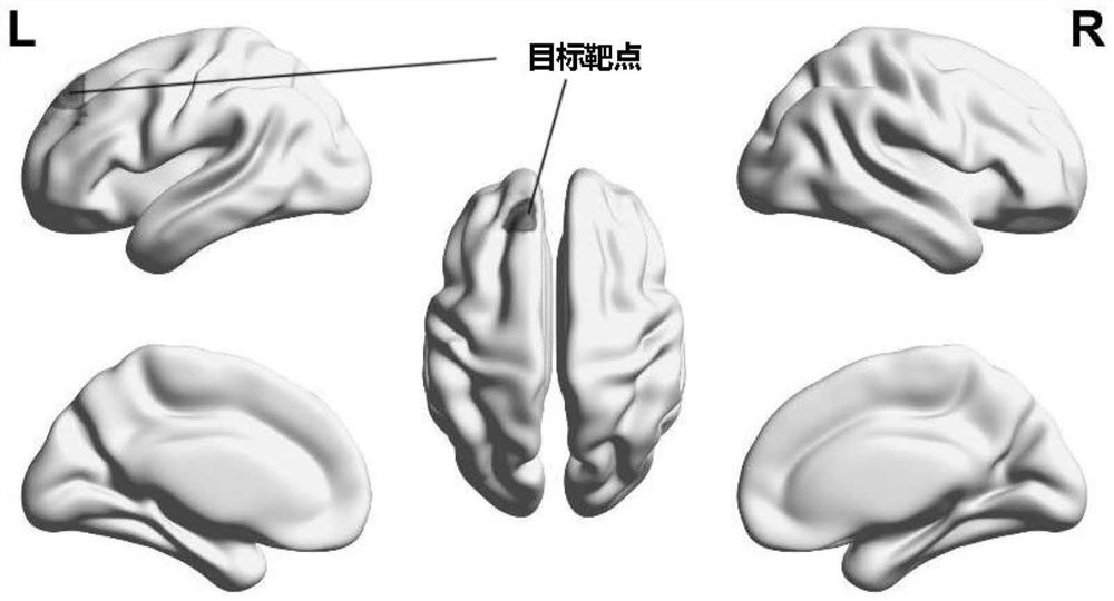 Individual space transcranial magnetic stimulation accurate positioning navigation method based on magnetic resonance imaging