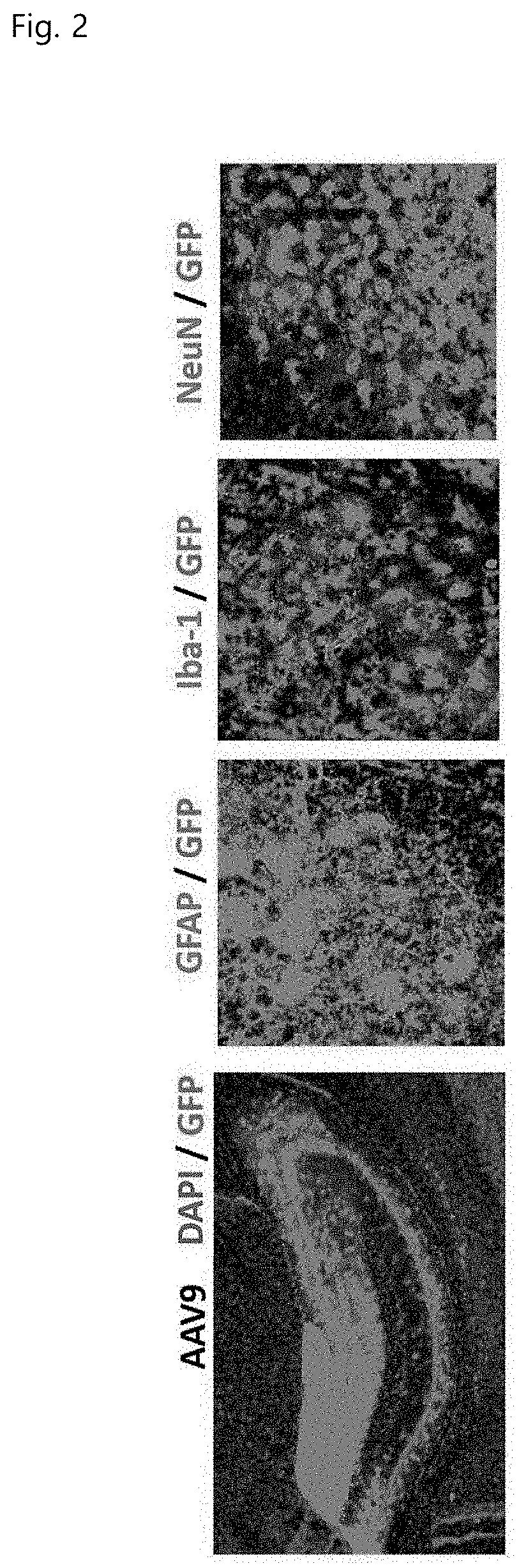 Composition and method for inhibiting tau protein accumulation, aggregation, and tangle formation