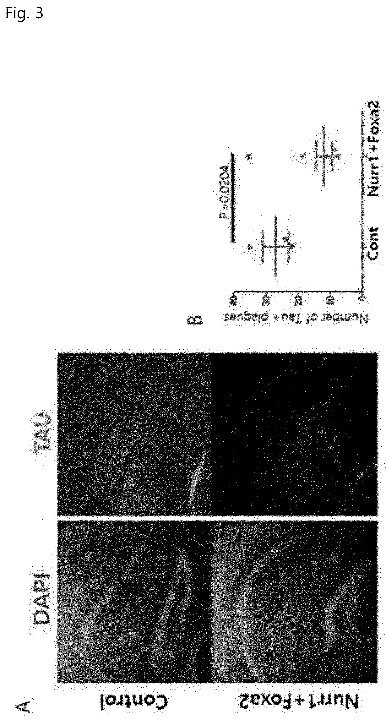 Composition and method for inhibiting tau protein accumulation, aggregation, and tangle formation