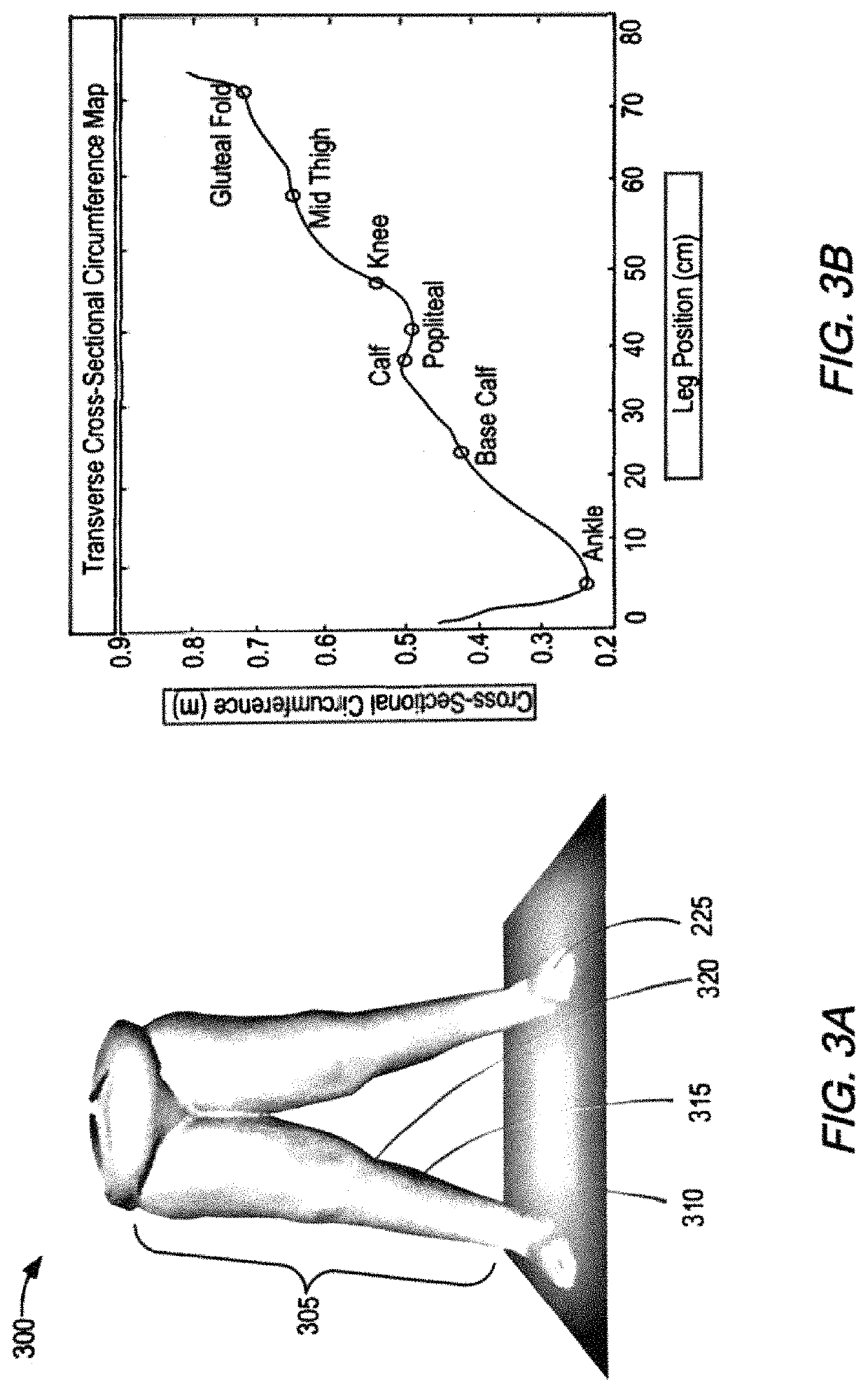Methods and systems for identifying body part or body area anatomical landmarks from digital imagery for the fitting of compression garments for a person in need thereof