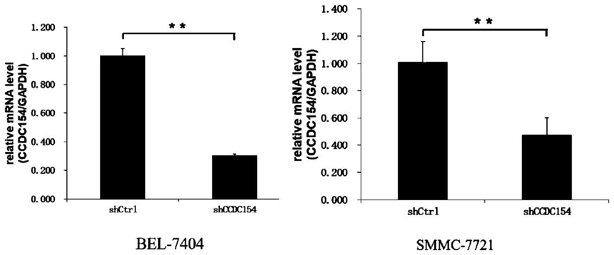 Application of human CCDC154 gene and related product
