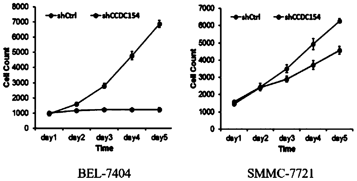 Application of human CCDC154 gene and related product