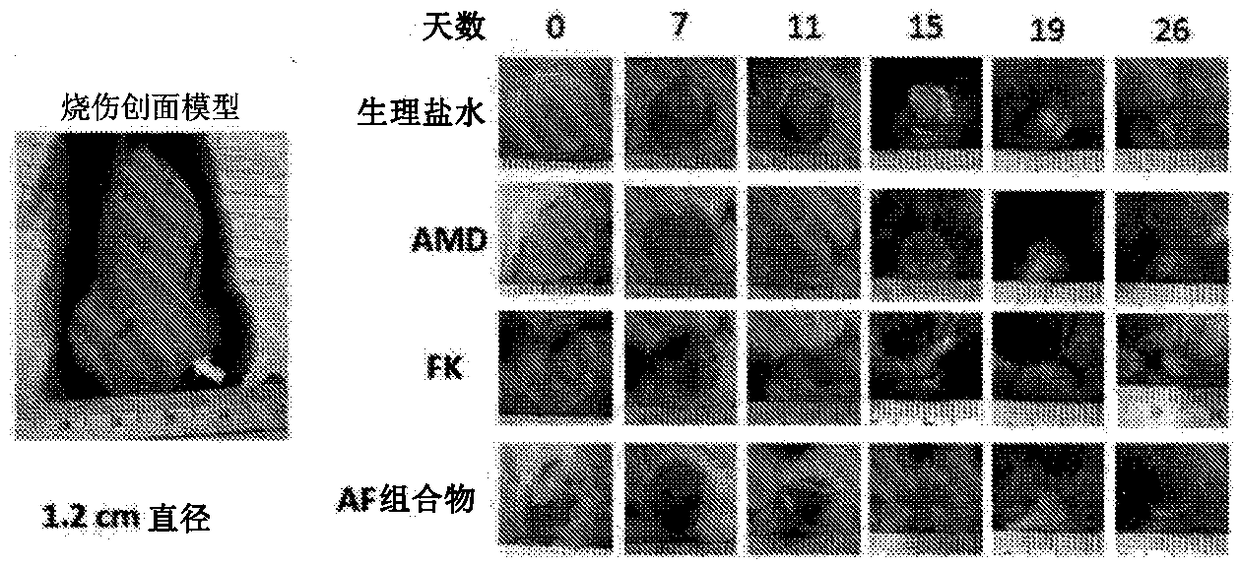 Pharmaceutical compositions useful for the treatment of tissue injury