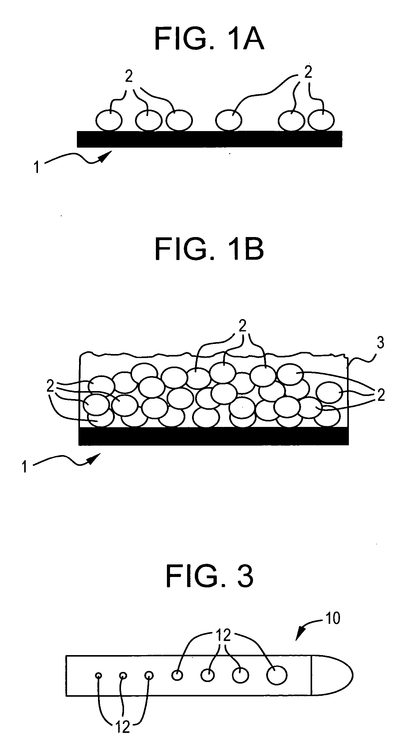 Fluid management flow implants of improved occlusion resistance