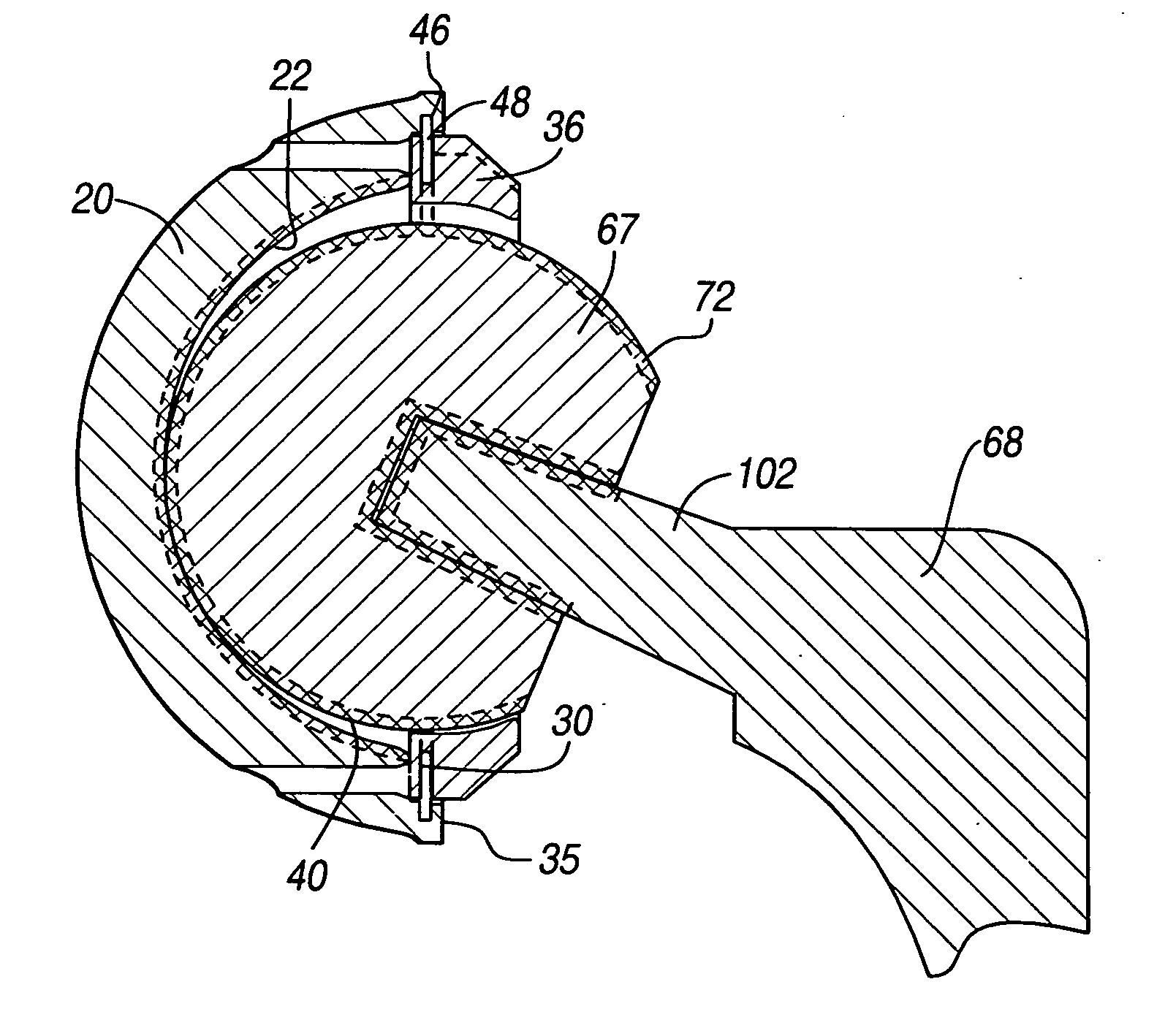 Method and apparatus for surface hardening implants