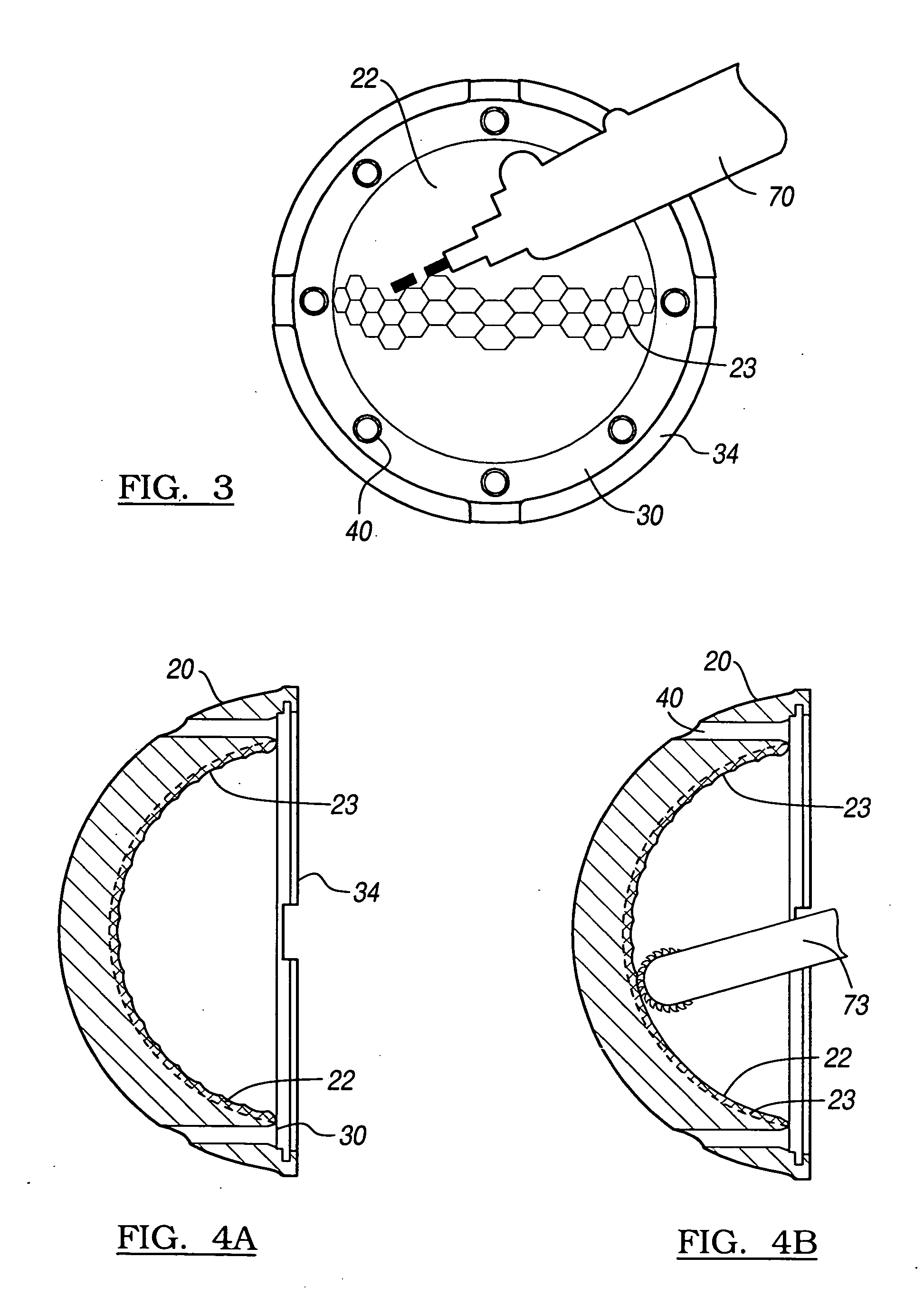Method and apparatus for surface hardening implants