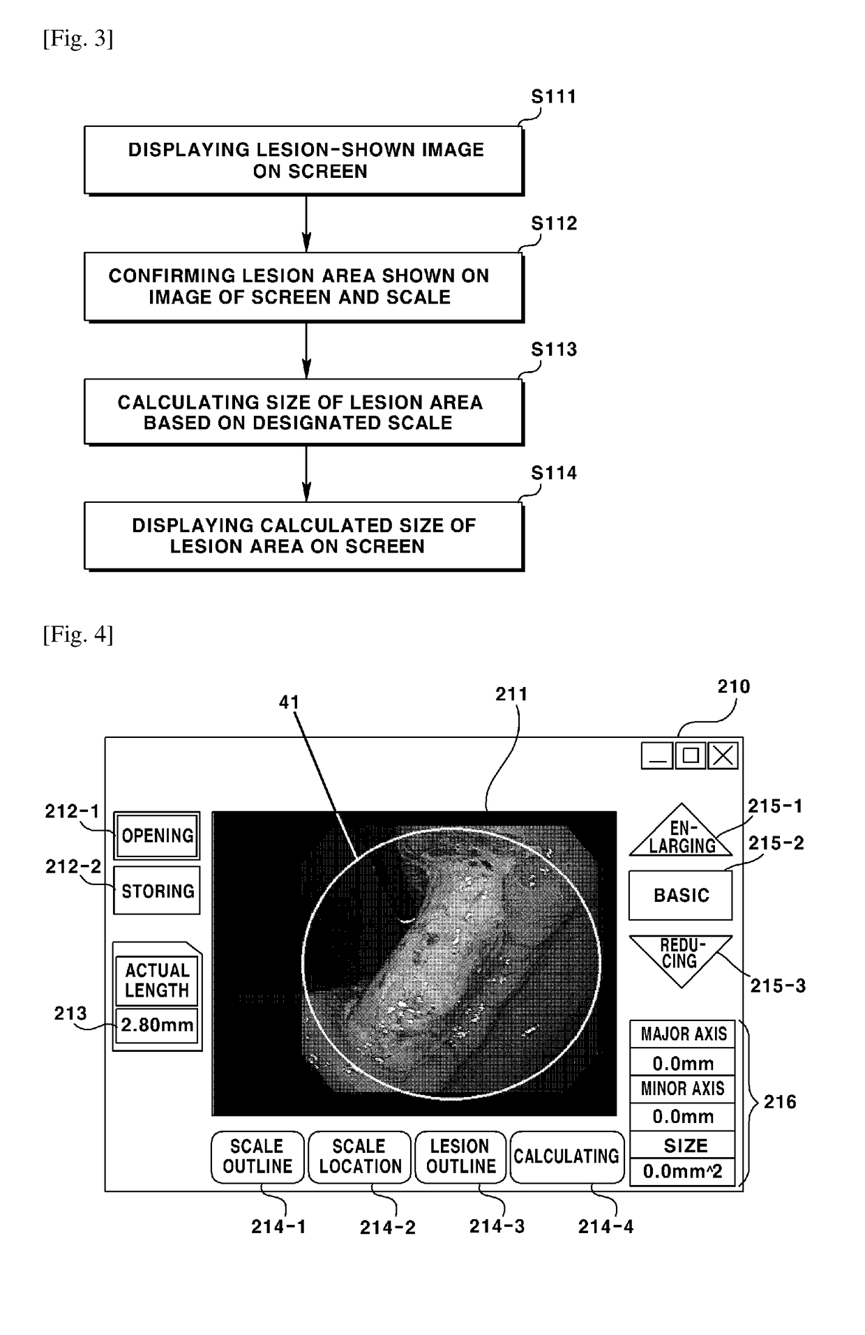 Method for measuring size of lesion which is shown by endoscope, and computer readable recording medium