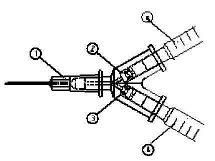 Medical syringe with vitreous cavity