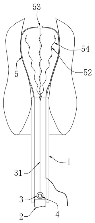 Drug delivery device for medical oncology