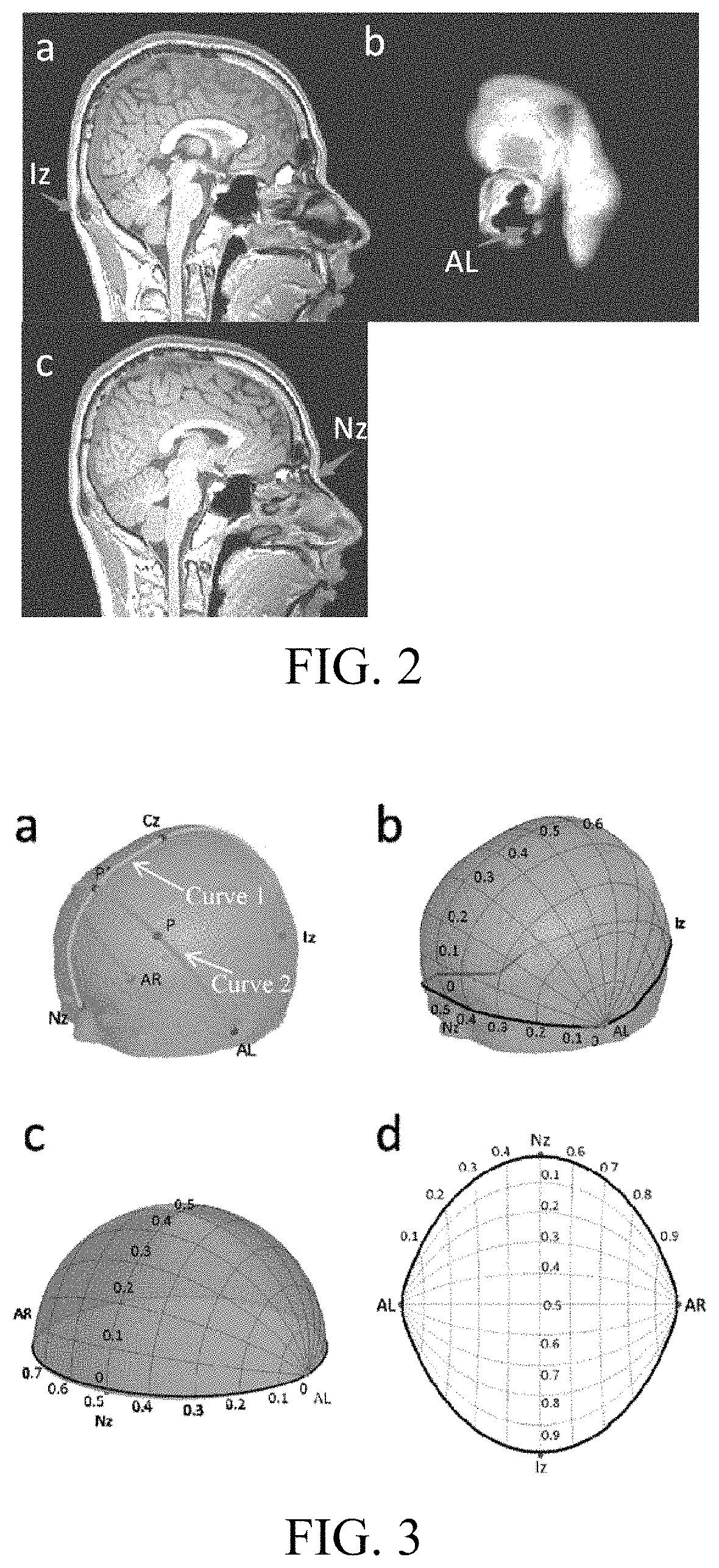 Individual-characteristic-based transcranial brain atlas generation method, navigation method, and navigation system
