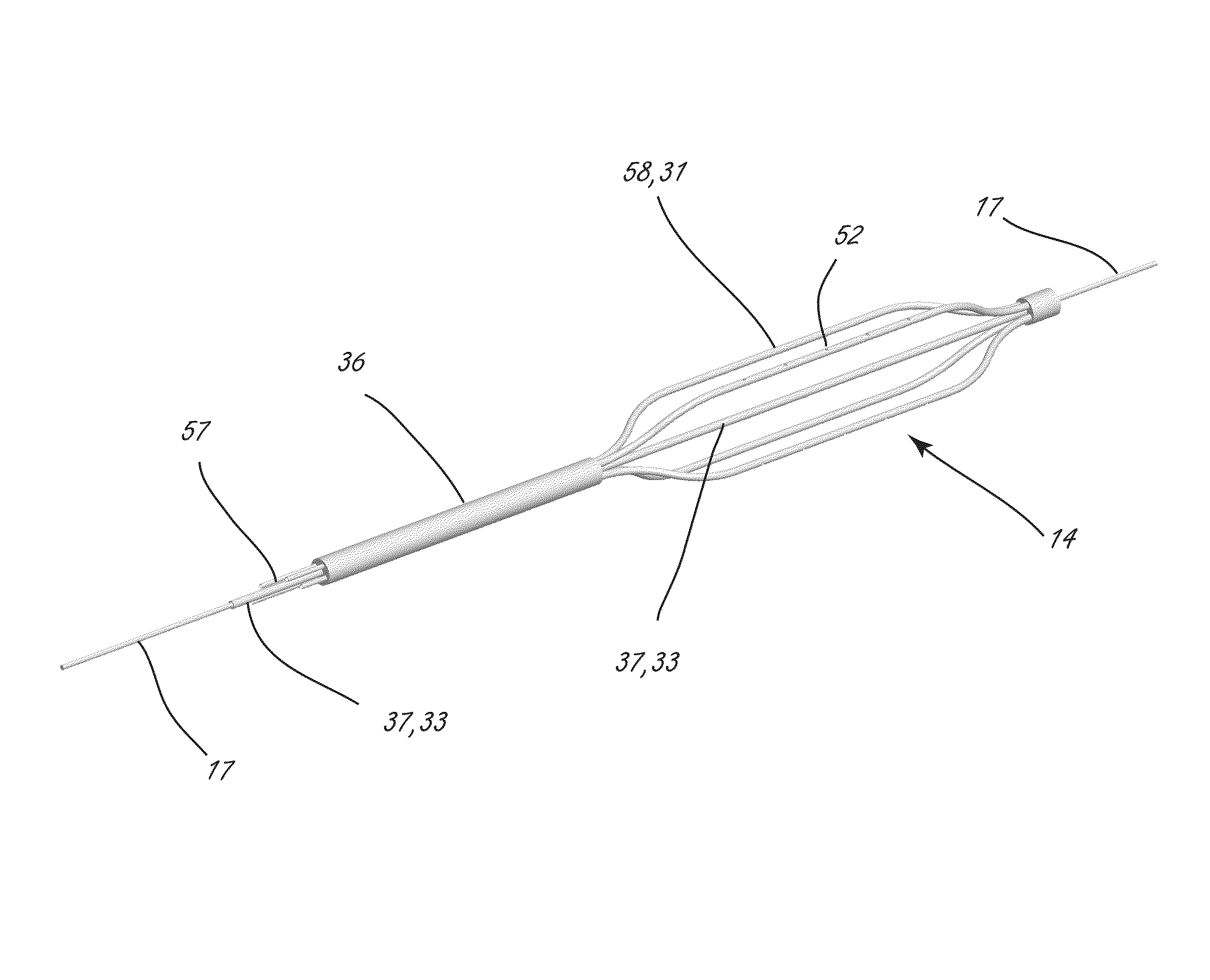 Intravascular tissue disruption