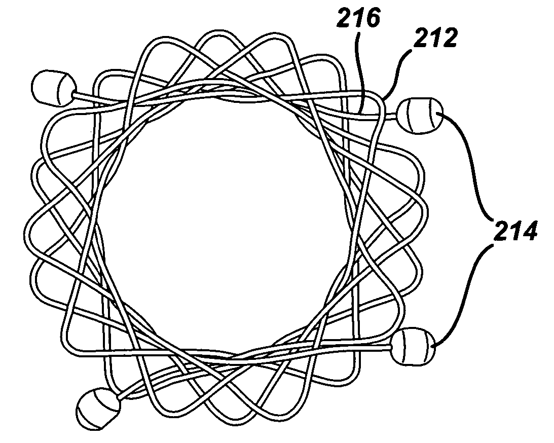 Anastomosis wire ring device