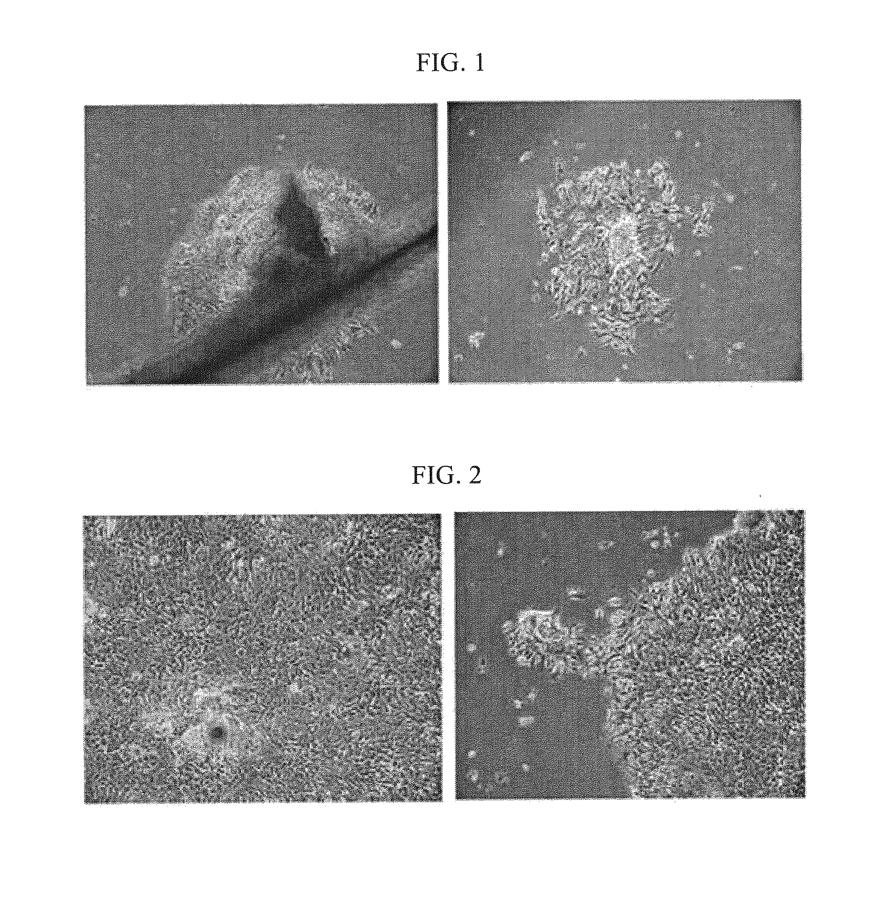 Method For Isolation of a Hair Follicle Stem Cell and a Composition For Hair Reproduction