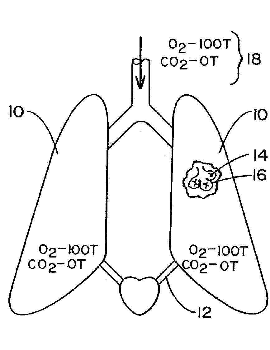 Non-invasive device and method for measuring the cardiac output of a patient