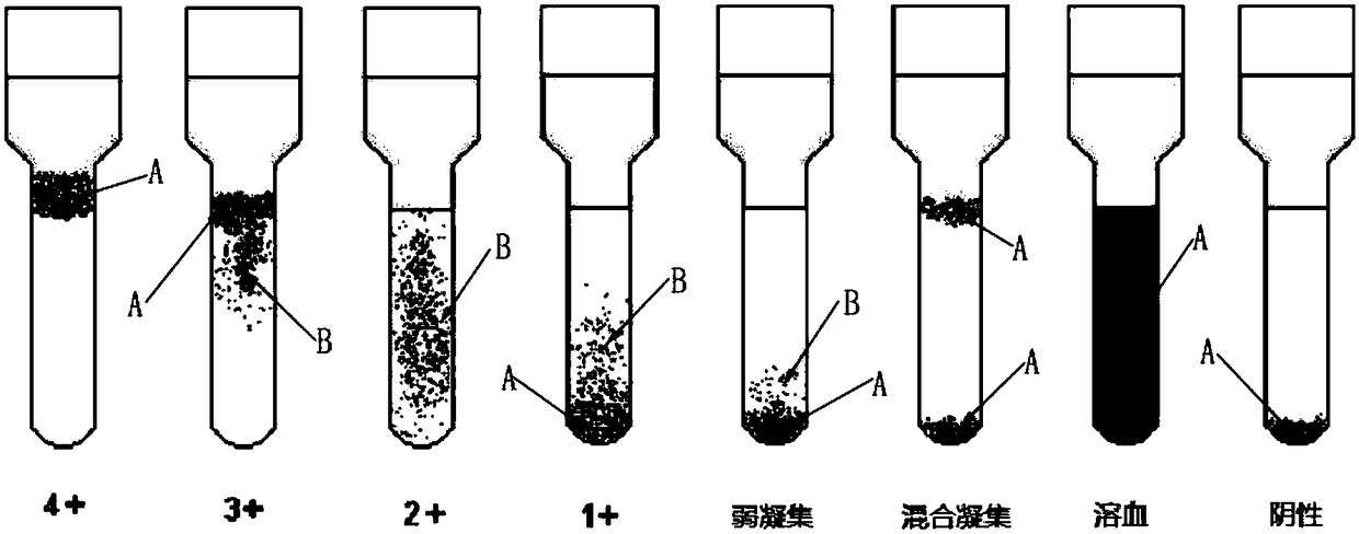 Micro-column gel card agglutination test result identification system and blood type analyzer