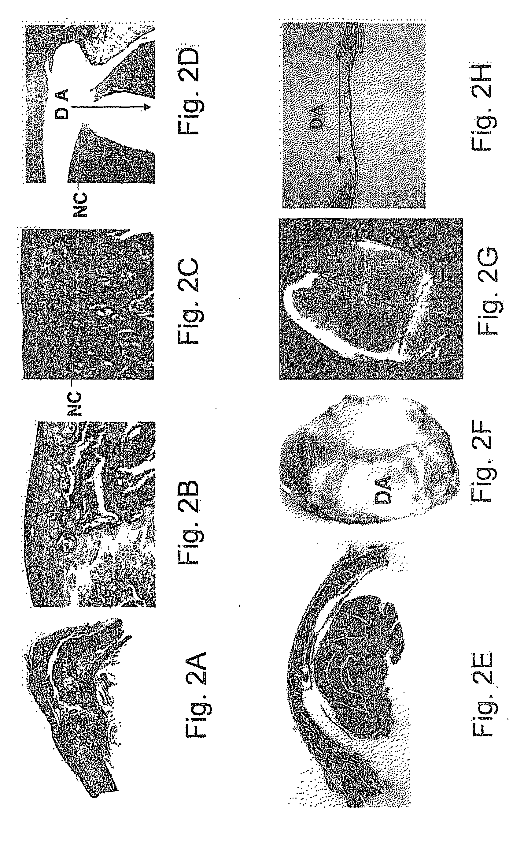 Compositions comprising bone marrow cells, demineralized bone matrix and various site-reactive polymers for use in the induction of bone and cartilage formation