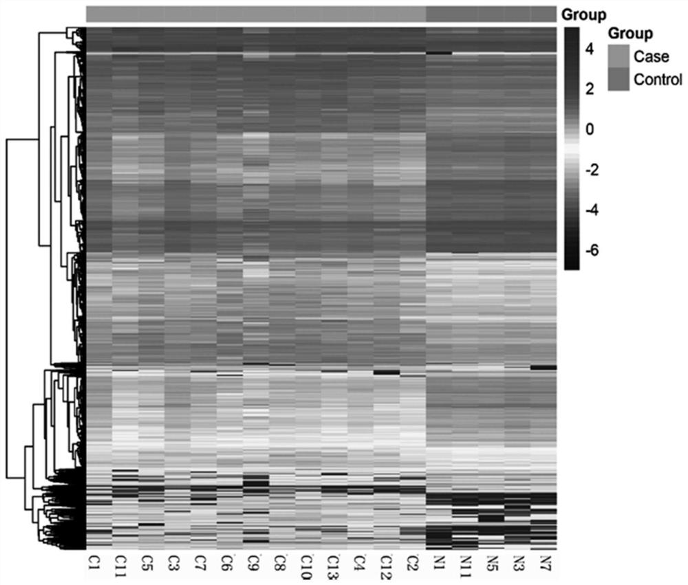 Application of SLIT3 in preparation of kit for prognosis of lung adenocarcinoma surgery patient