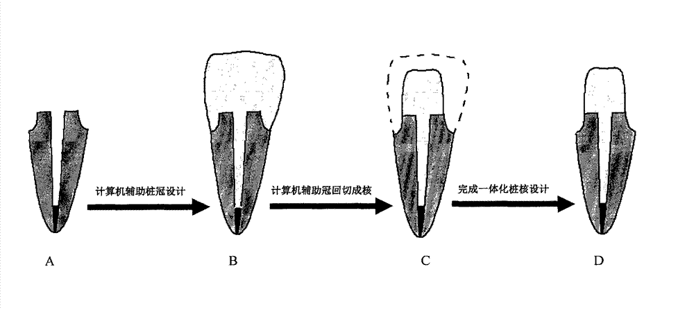 Preparation method of personalized and integrated all-ceramic post-and-core of dentistry