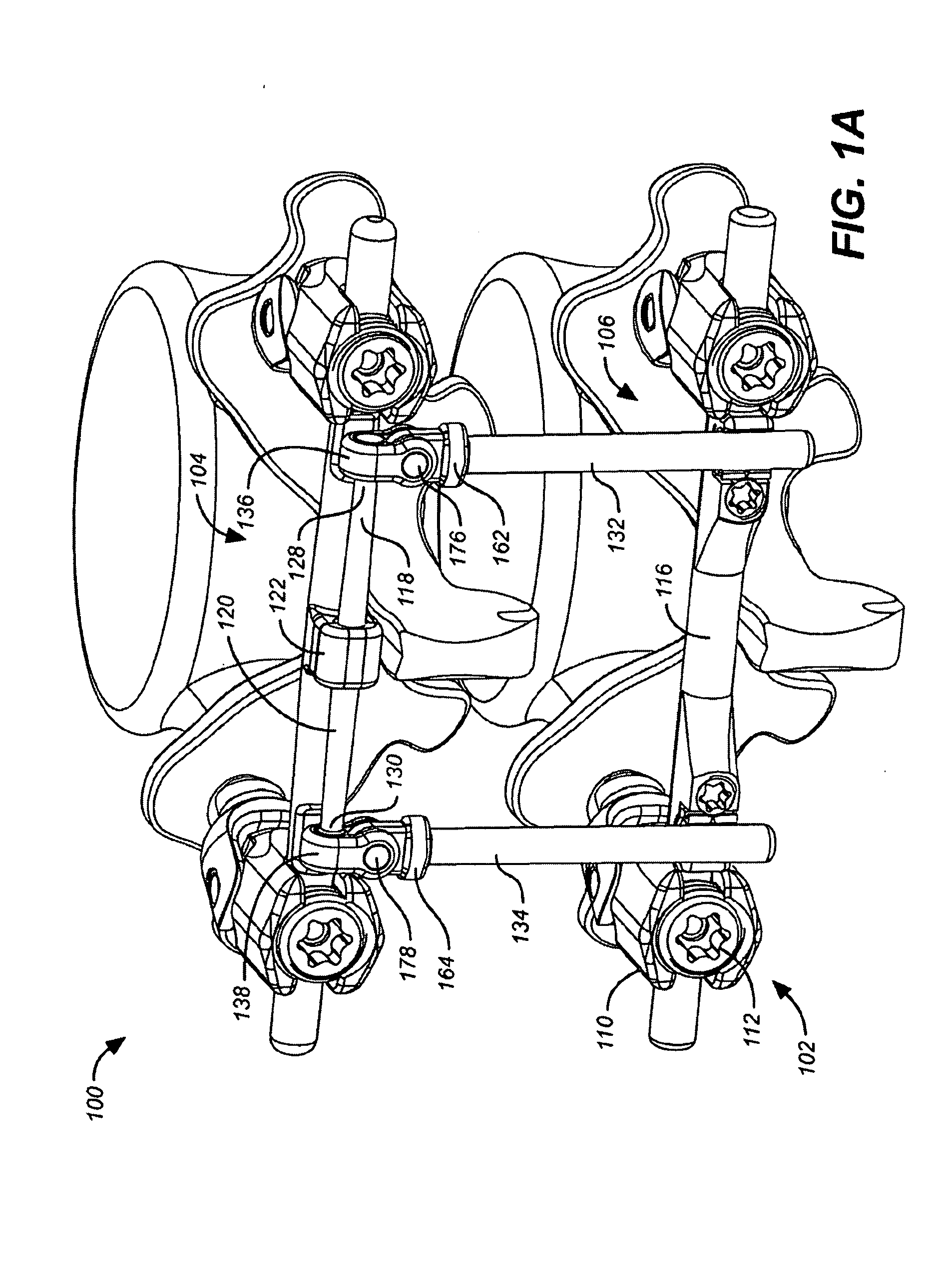 Deflection rod system for a dynamic stabilization and motion preservation spinal implantation system and method