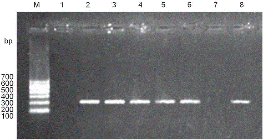 PCR detection kit and detection method of rana boulengeri-infected shewanella putrefaciens