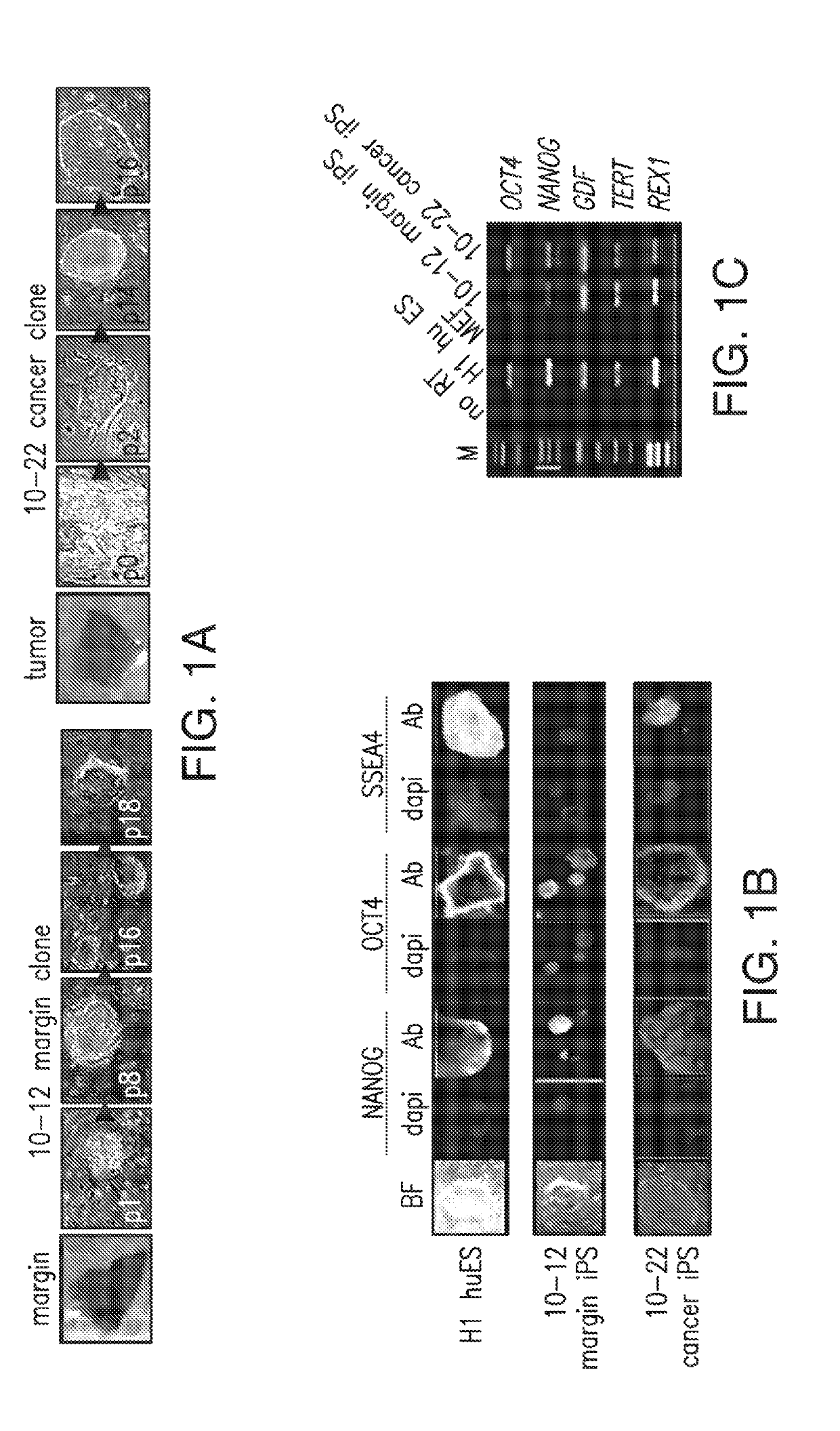 Methods for diagnosing pancreatic cancer